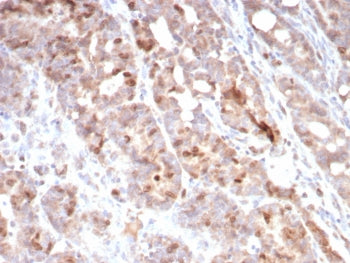 Survivin Antibody / BIRC5