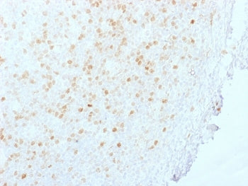 IHC staining of FFPE human tonsil with Aurora B antibody (clone AURKB/1845). HIER: boil tissue secti