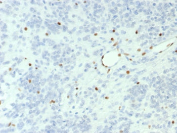 BRG1 Antibody / SMARCA4