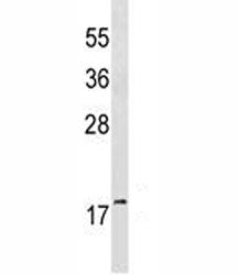 GABARAP antibody western blot analysis in mouse brain tissue lysate. Predicted molecular weight ~ 14