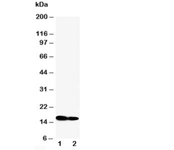 Western blot testing of IFITM1 antibody and Lane 1: SW620; 2: CEM cell lysate