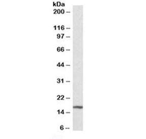 Western blot testing of mouse liver lysate with p16INK4a antibody at 0.3ug/ml. Predicted molecular w