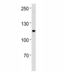 MSH2 Antibody