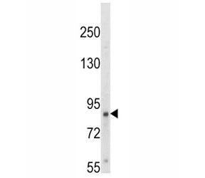 TrkA Antibody (NTRK1)