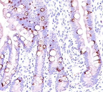 MUC2 Antibody / Mucin 2