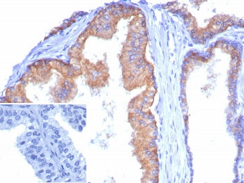 CD38 Antibody