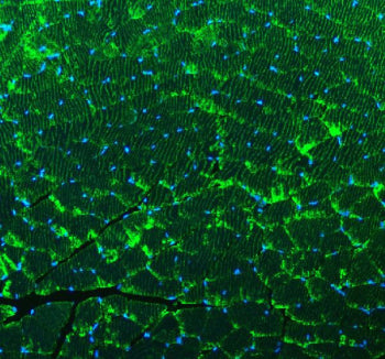 Immunofluorescent staining of FFPE mouse skeletal muscle tissue with ACTN3 antibody (green) and DAPI