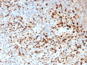 IHC staining of FFPE human cervix with HSV1 antibody. Required HIER: boil tissue sections in pH 9 10