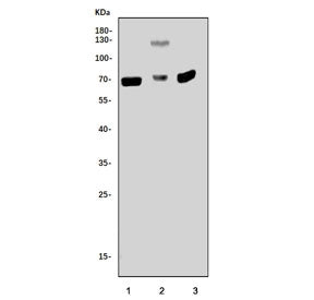 Western blot testing of 1) rat brain, 2) rat PC-12 and 3) mouse brain tissue lysate with p21-activat