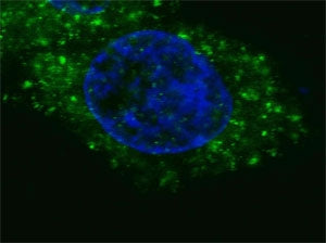Fluorescent confocal image of HepG2 cells stained with HGFR / MET antibody. Note the highly specific