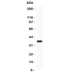 FSH beta Antibody