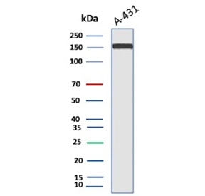 Western blot testing of A431 lysate using EGFR antibody. Expected molecular weight: 134-180 kDa depe