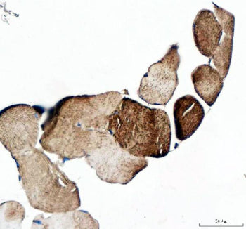 Immunohistochemical staining of MYOT using anti-MYOT antibody. MYOT was detected in a paraffin-embed