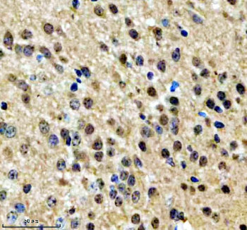 Immunohistochemical staining of NPAT using anti-NPAT antibody. NPAT was detected in a paraffin-embed
