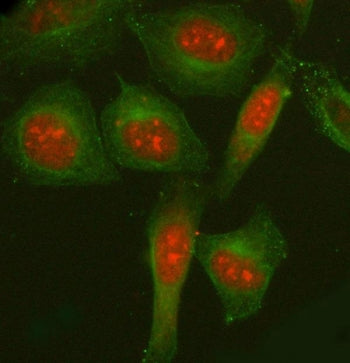 Immunofluorescent staining of FFPE human HeLa cells with NCOA5 antibody (red) and Beta Tubulin mAb (