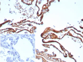 IHC staining of FFPE human lung tissue with recombinant Periostin antibody (clone POSTN/8523R). Inse
