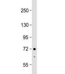ACSS3 Antibody