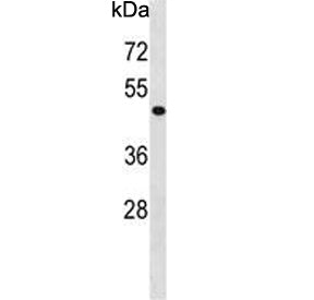 Western blot testing of human HepG2 cell lysate with PHKG2 antibody. Predicted molecular weight ~44 