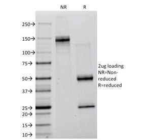 SDS-PAGE analysis of purified, BSA-free Lambda Light Chain antibody (clone ICO-106) as confirmation 
