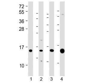 ATP6V1G3 Antibody (N-Terminal Region)