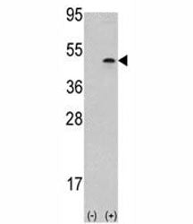 Western blot analysis of Aurora B antibody and 293 cell lysate (2 ug/lane) either nontransfected (La