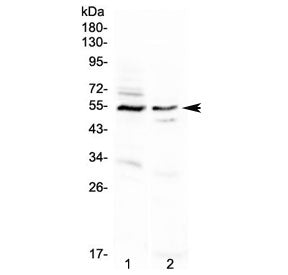 Western blot testing of human 1) A431 and 2) PANC-1 cell lysate with VIPR1 antibody. Predicted molec