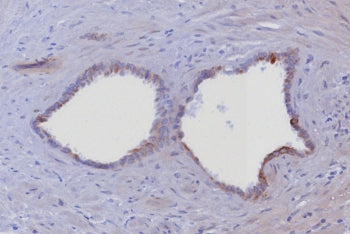 IHC staining of FFPE human prostate tissue with Cytokeratin 6 antibody (clone KRT6/8198R). HIER: boi