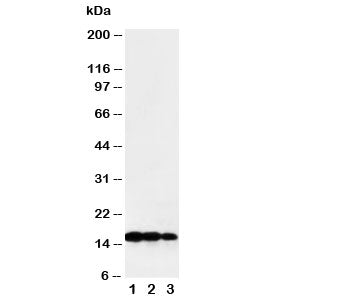 Western blot testing of TNF beta antibody and Lane 1: recombinant human protein 10ng; 2: 5ng; 3: 2.5