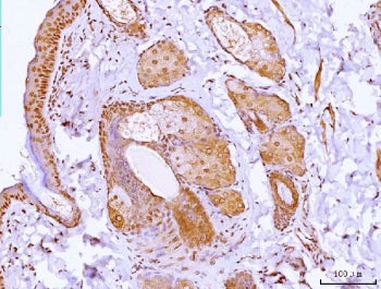 IHC staining of FFPE mouse skin tissue with HOXC12 antibody. HIER: boil tissue sections in pH8 EDTA 