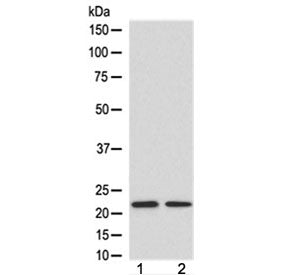 Western blot testing of 1) human HeLa and 2) mouse spleen lysate with FGF21 antibody at 0.5ug/ml. Pr