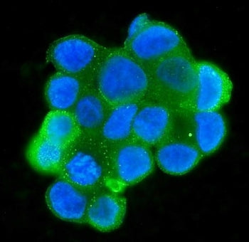 MPI Antibody / Mannose Phosphate Isomerase