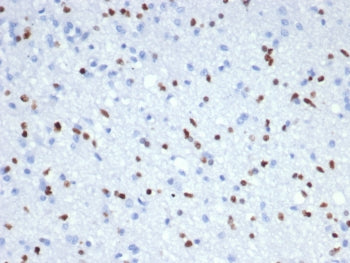 IHC staining of FFPE human brain tissue (RNA expression: 54.2 nTPM) with OLIG2 antibody (clone OLIG2