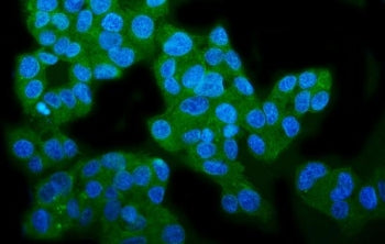 Immunofluorescent staining of FFPE human HepG2 cells with Wolframin antibody (green) and DAPI nuclea