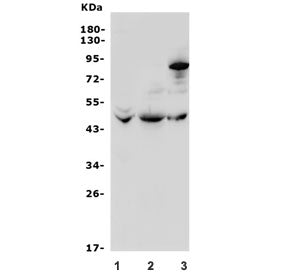 Western blot testing of 1) human HEK293, 2) rat liver and 3) mouse liver lysate with Beta 3 Adrenerg