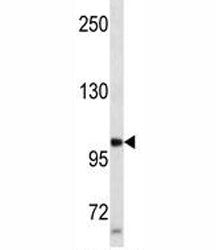 Progesterone Receptor antibody western blot analysis in SK-BR-3 lysate. Expected molecular weight: 8