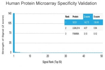 SOD1 Antibody / Superoxide Dismutase 1