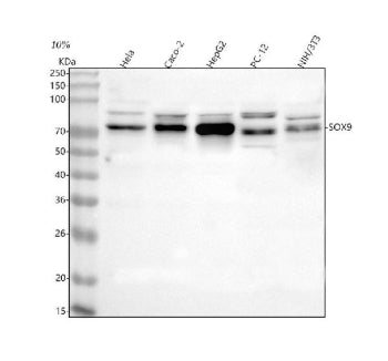 Western blot analysis of SOX9 using anti-SOX9 antibody. Lane 1: human Hela whole cell lysates, Lane 