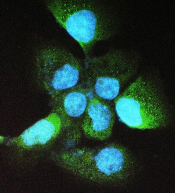 Alcohol dehydrogenase 5 Antibody / ADH5