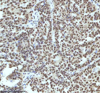 Immunohistochemical staining of IRF2BP1 using anti-IRF2BP1 antibody. IRF2BP1 was detected in a paraf