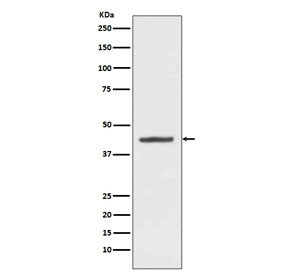 Western blot testing of human HepG2 cell lysate with HMBS antibody. Predicted molecular weight ~39 k