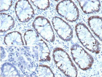 IHC staining of FFPE human colon tissue with Caudal type homeobox transcription factor 2 antibody (c