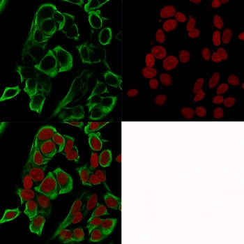 Immunofluorescence testing of human MCF7 cells with recombinant EpCAM antibody (green, clone rMOC-31