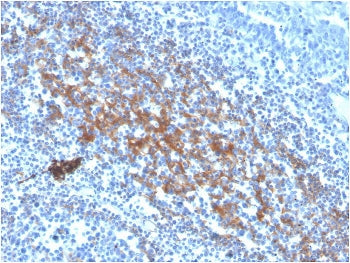 IHC staining of FFPE human tonsil tissue with biotinylated CD73 antibody (clone NT5E/2646). HIER: bo