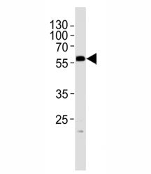PHF1 Antibody