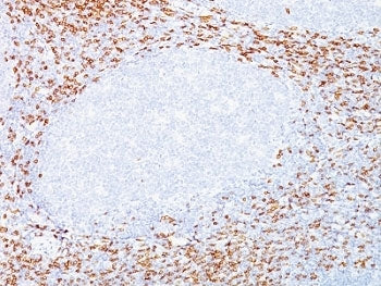 IHC: Formalin-fixed, paraffin-embedded human tonsil stained with CD8a antibody (C8/468 + C8/144B).