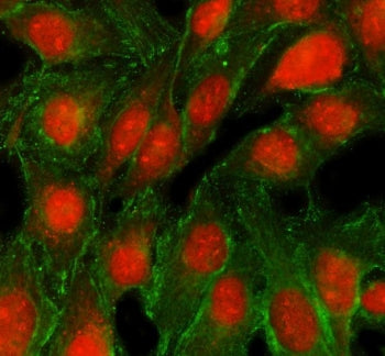 TRMT5 Antibody / tRNA methyltransferase 5