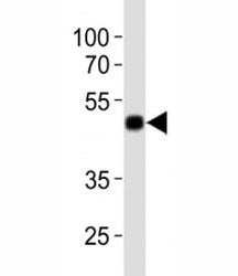 His Antibody