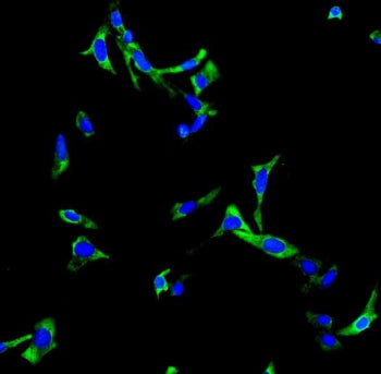 Immunofluorescent staining of FFPE human U-2 OS cells with ChAT antibody (green) and DAPI nuclear st