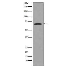 Western blot testing of human HeLa cell lysate with CDC7 antibody. Predicted molecular weight ~64 kDa.