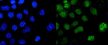 Pokemon Antibody / ZBTB7A